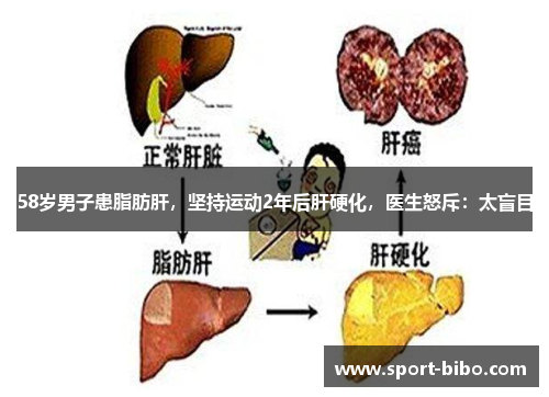 58岁男子患脂肪肝，坚持运动2年后肝硬化，医生怒斥：太盲目